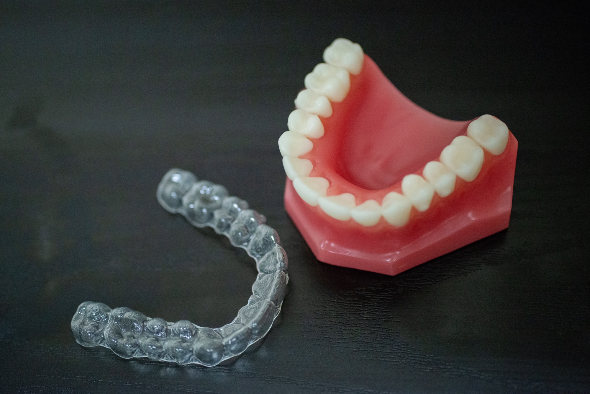 A clear aligner tray and dental model held in hand at Northern Virginia Dental Solutions in Vienna, Virginia