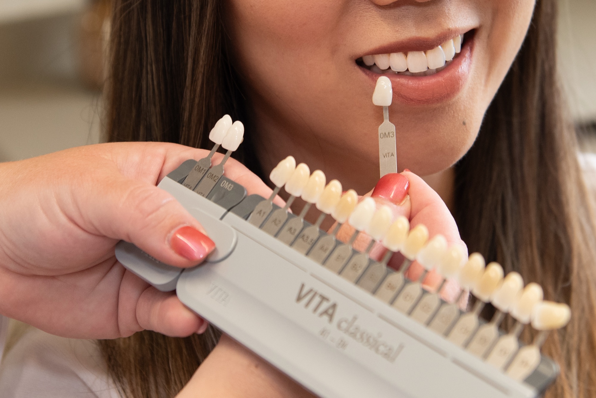 A VITA shade guide held beside a patient's smile to match the color of her teeth